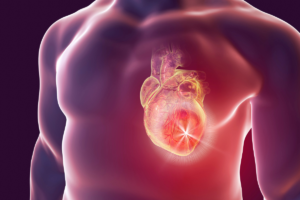 Read more about the article Tudo o que você precisa saber sobre – Infarto
